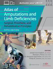Atlas of Amputations and Limb Deficiencies 5