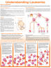 Understanding Leukemia Anatomical Chart