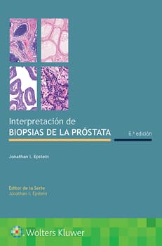 Interpretación de biopsias de la próstata