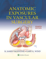 Anatomic Exposures in Vascular Surgery