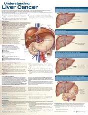 Understanding Liver Cancer Anatomical Chart