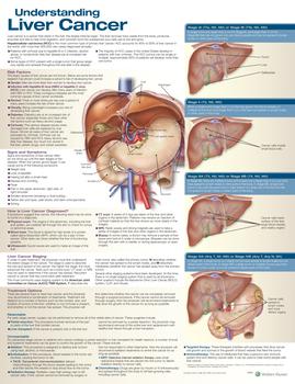 Understanding Liver Cancer Anatomical Chart