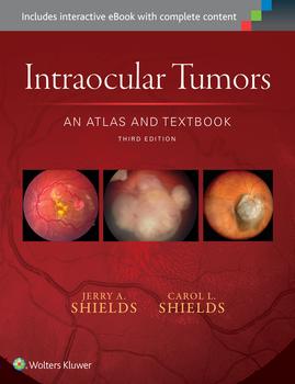 Intraocular Tumors: An Atlas and Textbook