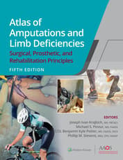 Atlas of Amputations and Limb Deficiencies