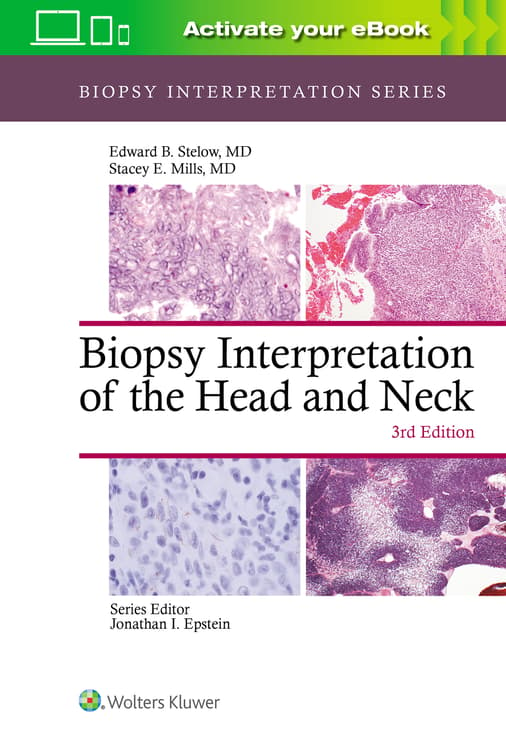 Biopsy Interpretation of the Head and Neck