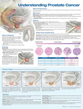 Understanding Prostate Cancer Anatomical Chart