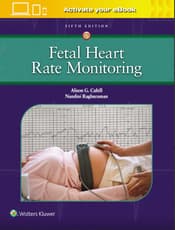 Fetal Heart Rate Monitoring