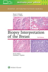 Biopsy Interpretation of the Breast