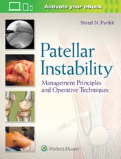 Patellar Instability