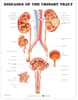 Diseases of the Urinary Tract Anatomical Chart