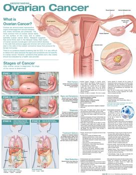 Understanding Ovarian Cancer Anatomical Chart