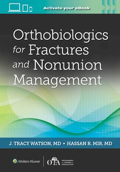 Orthobiologics for Fractures and Nonunion Management