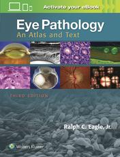 Eye Pathology