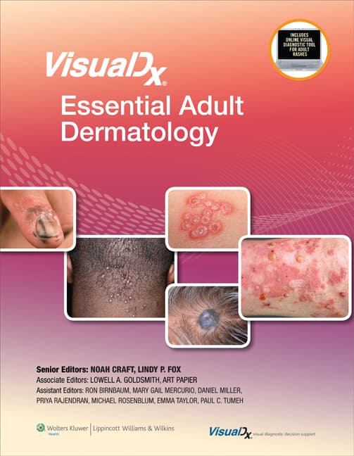 VisualDx: Essential Adult Dermatology