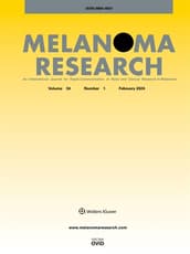 Melanoma Research