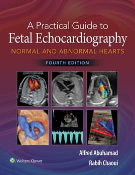 柔らかな質感の Practical A Guide Echocardiography Fetal 洋書
