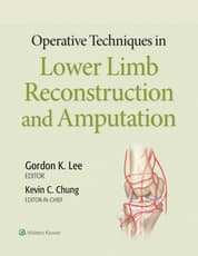 Operative Techniques in Plastic Surgery: Lower Limb Surgery