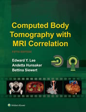 Computed Body Tomography with MRI Correlation