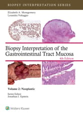 Biopsy Interpretation of the Gastrointestinal Tract Mucosa Volume 2