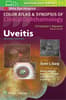 Uveitis