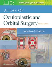 Atlas of Oculoplastic and Orbital Surgery