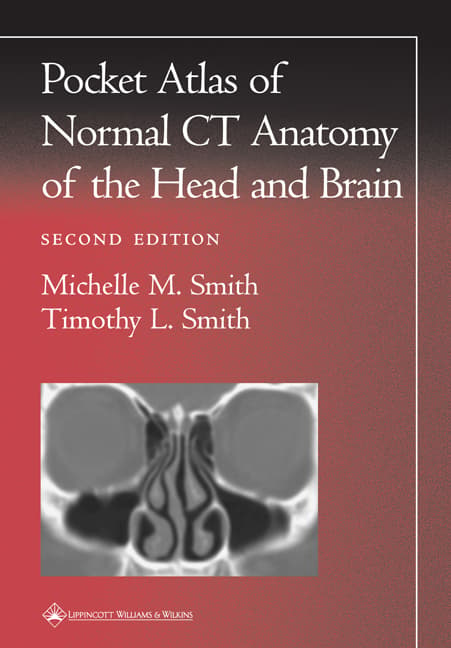 Pocket Atlas of Normal CT Anatomy of the Head and Brain