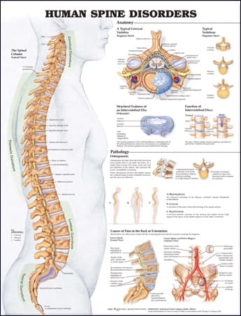 Human Spine Disorders Anatomical Chart