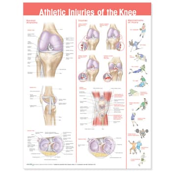 Athletic Injuries of the Knee Anatomical Chart