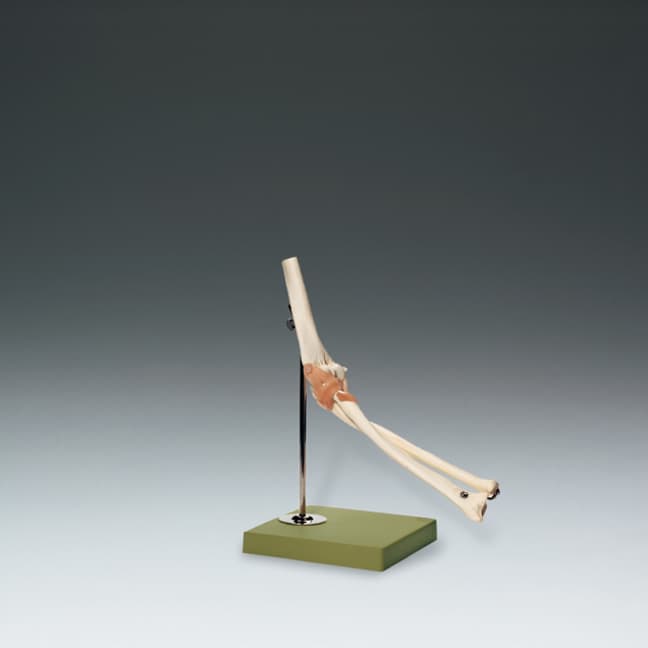 Functional Model of the Elbow Joint