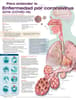 Para entender la Enfermedad por coronavirus 2019 (COVID-19)