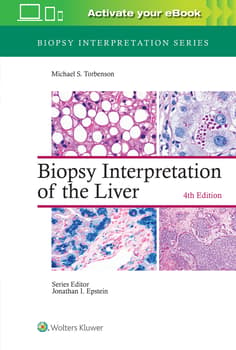 Biopsy Interpretation of the Liver