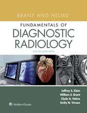 Brant and Helms' Fundamentals of Diagnostic Radiology