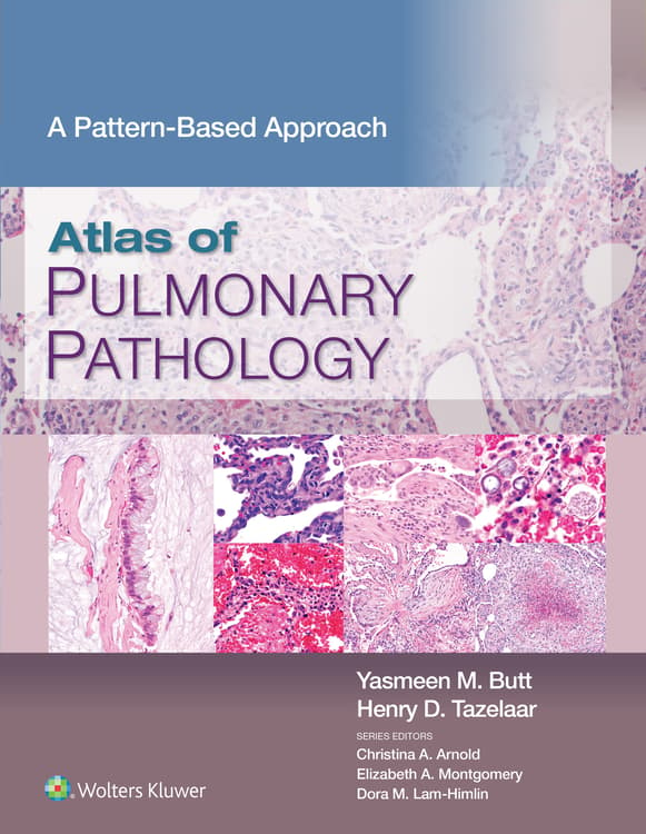 Atlas of Pulmonary Pathology