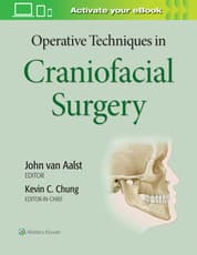 Operative Techniques in Plastic Surgery - Wolters Kluwer