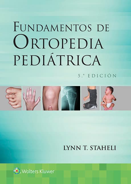 Fundamentos de ortopedia pediátrica