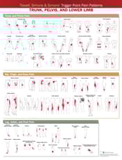 Travell, Simons & Simons’ Trigger Point Pain Patterns Wall Chart