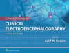 Current Practice of Clinical Electroencephalography