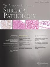American Journal of Surgical Pathology Online