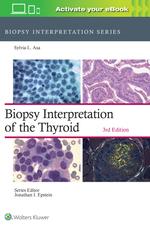 Biopsy Interpretation of the Thyroid