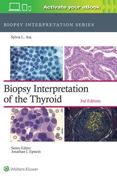 Biopsy Interpretation of the Thyroid