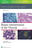 Biopsy Interpretation of the Thyroid