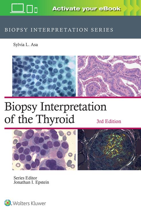 Biopsy Interpretation of the Thyroid