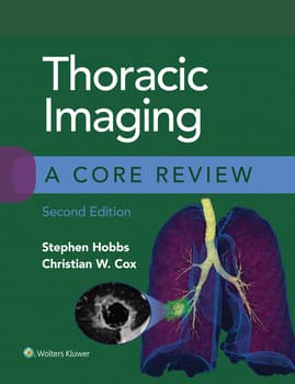 Thoracic Imaging: A Core Review