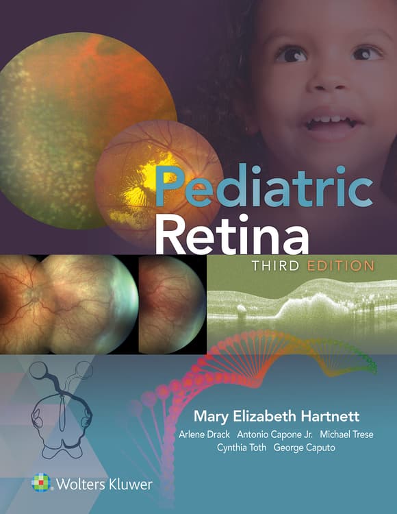 Pediatric Retina