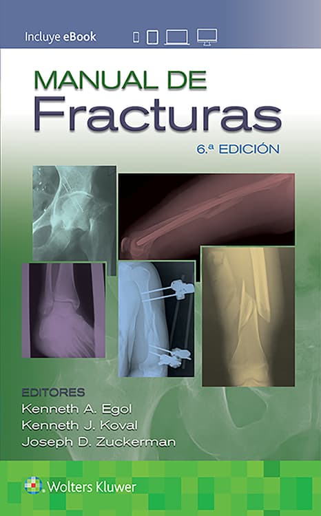 Manual de fracturas