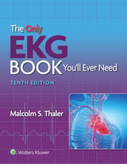 The Only EKG Book You’ll Ever Need