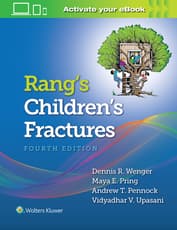 Rang's Children's Fractures