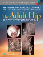 The Adult Hip