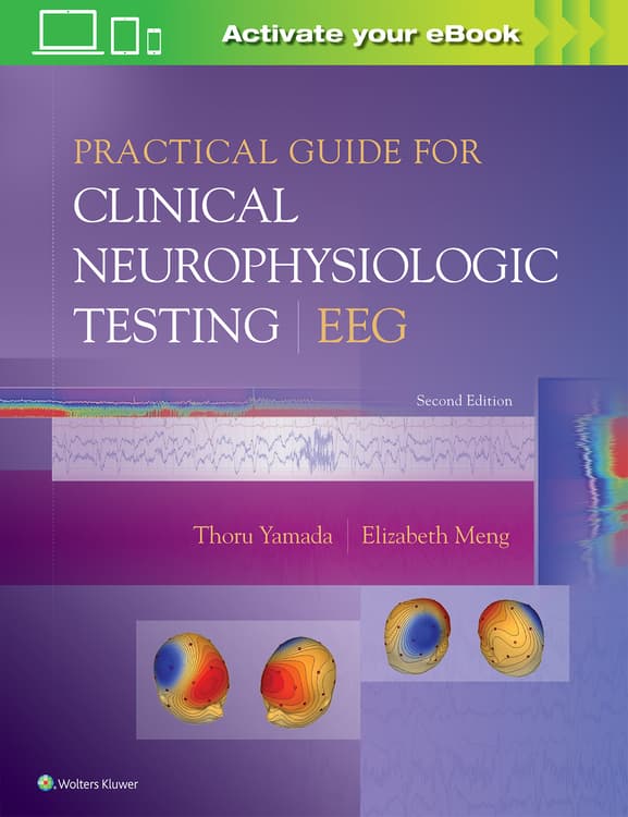 Practical Guide for Clinical Neurophysiologic Testing: EEG