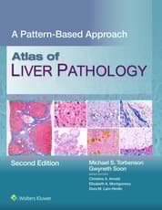 Atlas of Liver Pathology
